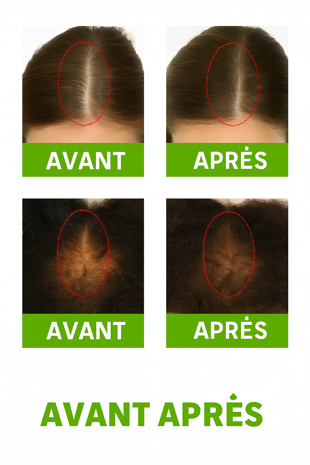Pack Pousse Syulli - Huile + Sérum